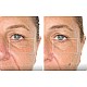 TheraFace Mask Glo - ICE Facial Mask | Vibration Therapy