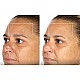 TheraFace Mask Glo - ICE Facial Mask | Vibration Therapy