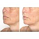 TheraFace Mask Glo - ICE Facial Mask | Vibration Therapy