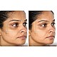 TheraFace Mask Glo - ICE Facial Mask | Vibration Therapy