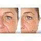 TheraFace Mask Glo - ЛЕД Маска за Лице | Вибрационна терапия