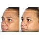 TheraFace Mask Glo - ЛЕД Маска за Лице | Вибрационна терапия