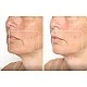 TheraFace Mask Glo - ЛЕД Маска за Лице | Вибрационна терапия