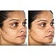 TheraFace Mask Glo - ЛЕД Маска за Лице | Вибрационна терапия