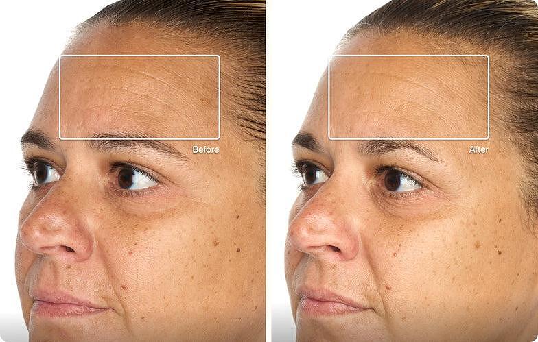 TheraFace Mask Glo - ЛЕД Маска за Лице | Вибрационна терапия